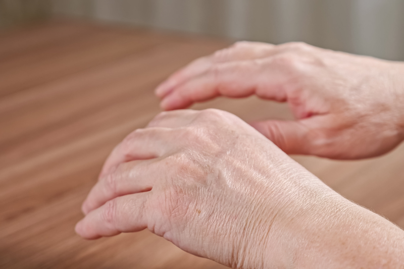 dấu hiệu bị stress nghiêm trọng