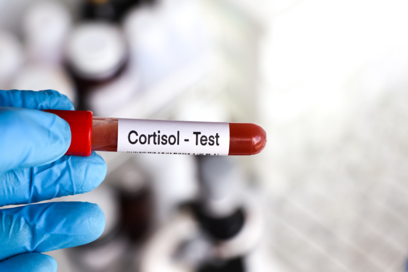 stress làm tăng cortisol